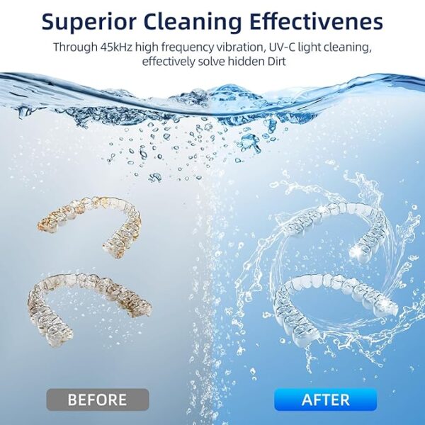 Ultrasonic Retainer Cleaner - Image 4