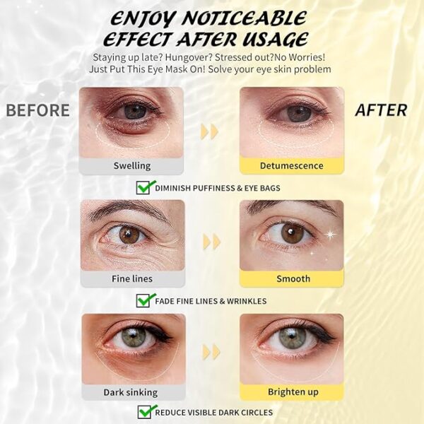 Under Eye Patches - Image 3